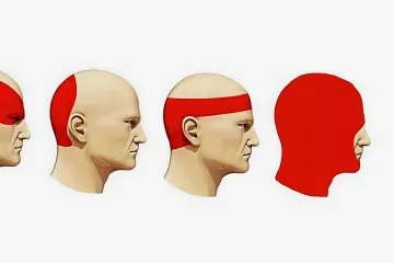 Four illustrations of a head with different areas highlighted in red.