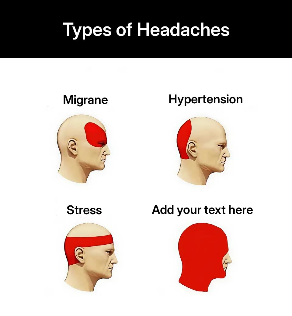 Four illustrations of a head with different areas highlighted in red.